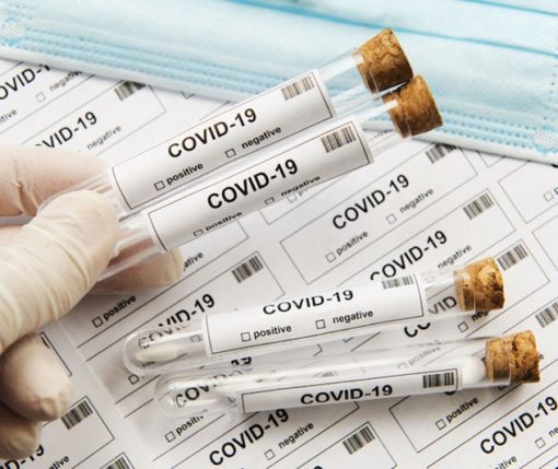 ЯК ПІДГОТУВАТИСЯ ДО ПЛР-ТЕСТУ