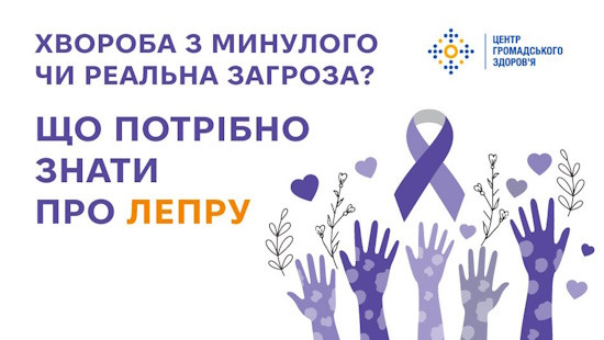 Хвороба з минулого чи реальна загроза? Що потрібно знати про лепру